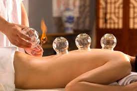 Cupping